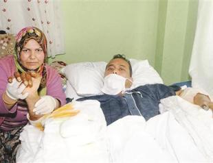 Arm transplant patient holds hands with wife