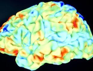 Mind-reading device tried on Stephen Hawking