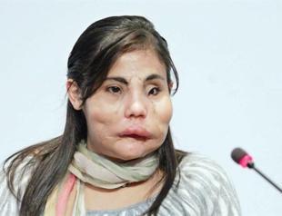 Doctor gives details of transplant operation in Turkey