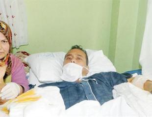 Turkish limb transplant patient under critical condition