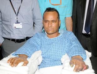 Turkish limb-transplant patient dies