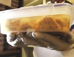 Freezer fault destroys brain data