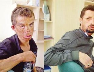 Transplant patient stunned by change