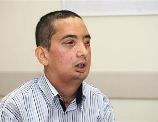 Fourth face transplant patient sees new face