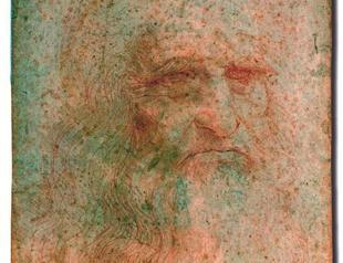 Leonardo in critical condition