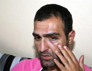 Lawsuit opened against man beaten by Turkish police