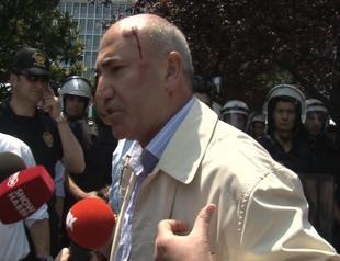 Opposition deputy wounded in clash with police during protest