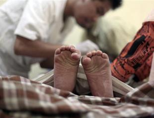 German court’s move to ban circumcision unites religions