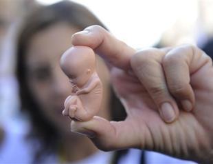 248 human fetuses found in Russian forest