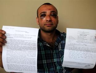 Turkish police allegedly gas man holding infant son