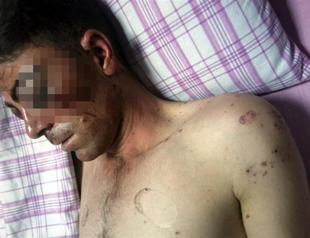 Smuggler shot in head by police at check point in eastern Turkey: report