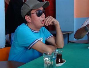 Fourth face-transplant patient learns to laugh