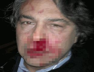 Renowned Turkish designer attacked for political statements