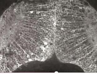 Brain scans show how pain is like