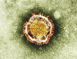 New SARS-like virus can pass person-to-person, says WHO