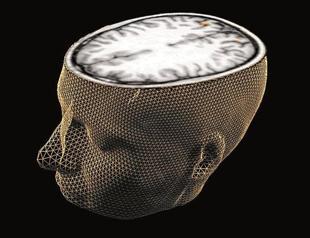 Injuries to brain may bring suicidal thoughts