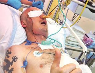 Polish doctors claim first life-saving face transplant