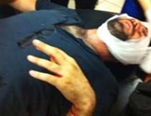 Veteran Hürriyet photojournalist injured by police taken to hospital
