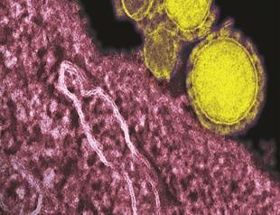 Deadly coronavirus serious risk in hospitals