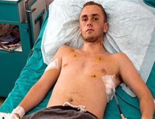 British tourist out of intensive care after attack in Turkey’s Marmaris