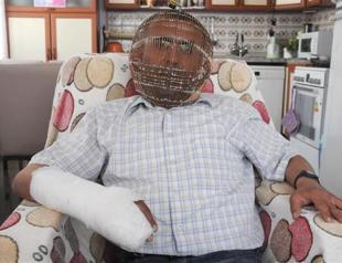 Turkish man wears helmet-like head cage to quit smoking