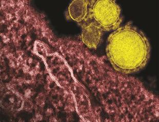 MERS coronavirus not yet pandemic