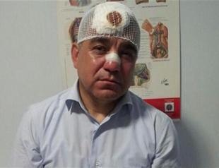 Turkish lawmaker claims his nose was broken in police attack