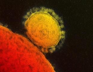 No MERS case in Turkey yet