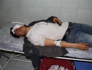 15-year-old blinded by a tear gas canister in southeastern Turkey during election protests