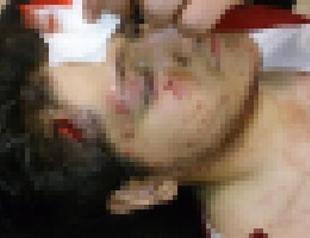 Footage showing student hit by police gas canister draws reactions