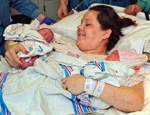 One body, two faces: rare twins born in Sydney