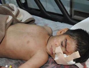 Six-year-old boy hit in eye by tear gas canister while ‘looking out of window’