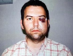 Police officer who injured Gezi protester in eye to be searched for until 2028