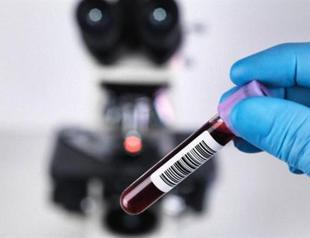 Scientists closer to blood test for Alzheimers