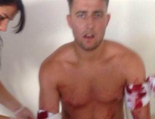 Two wounded in sunbed fight between British tourists in Turkish resort