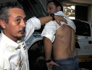 Turkish rally drivers win race after getting beaten up by Energy Minister’s bodyguards