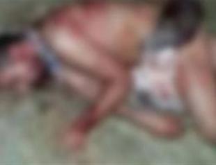 One passerby stabbed, another shot during Kobane protests in Istanbul suburb