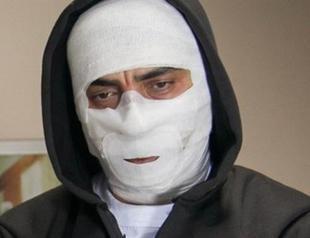 Turkish drama star discharged from hospital after breaking jaw