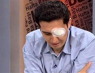 Security footage shows police officers firing teargas canisters that left research assistant blind