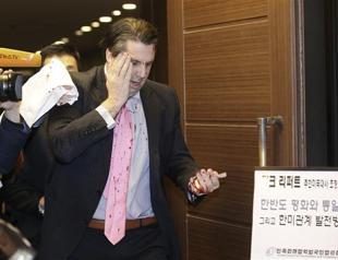 US ambassador slashed and bloodied in Seoul attack