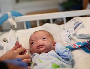 US mom: Baby born without nose is perfect the way he is