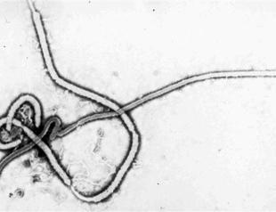 Experts denounce WHO’s slow Ebola response