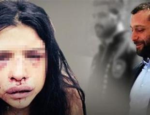 Turkish convict beats girlfriend on first day of freedom