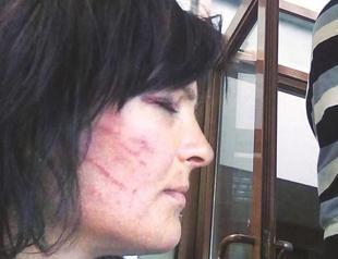 Doctor fined over inaccurate report on tortured woman in Turkeys west