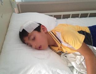 7-year-old boy shot with tear gas canister in Istanbul