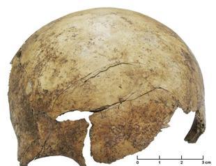 Scientists find evidence of prehistoric massacre in Europe