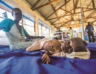 Cheap microscope could improve medical care in poor nations