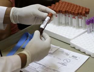 WHO calls for special meeting over Zika virus