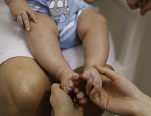 Zika can trigger severe neurological disorder, says study