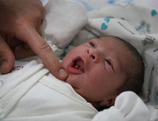 Turkish baby born with two lower teeth